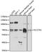 Long-chain fatty acid transport protein 1 antibody, 14-659, ProSci, Western Blot image 