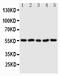 Syndecan 3 antibody, PA2133, Boster Biological Technology, Western Blot image 