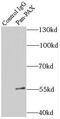 Paired box protein Pax-8 antibody, FNab06136, FineTest, Immunoprecipitation image 