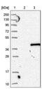 Sarcoglycan Delta antibody, PA5-55470, Invitrogen Antibodies, Western Blot image 