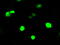 Rho GDP Dissociation Inhibitor Alpha antibody, M03135-1, Boster Biological Technology, Immunofluorescence image 