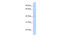 Gasdermin B antibody, 25-777, ProSci, Western Blot image 