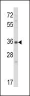 Cellular Communication Network Factor 2 antibody, LS-C96712, Lifespan Biosciences, Western Blot image 