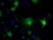 Isocitrate Dehydrogenase (NADP(+)) 1, Cytosolic antibody, GTX84319, GeneTex, Immunofluorescence image 