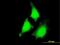 Mitogen-Activated Protein Kinase Kinase 5 antibody, MA5-19711, Invitrogen Antibodies, Immunofluorescence image 