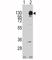 Platelet Derived Growth Factor Receptor Alpha antibody, F50658-0.4ML, NSJ Bioreagents, Western Blot image 