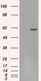 Fyn Related Src Family Tyrosine Kinase antibody, TA500549, Origene, Western Blot image 