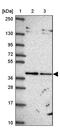 Mitochondrial import inner membrane translocase subunit TIM50 antibody, PA5-63305, Invitrogen Antibodies, Western Blot image 