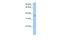 Acid Phosphatase 4 antibody, PA5-69675, Invitrogen Antibodies, Western Blot image 