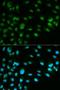 Minichromosome Maintenance Complex Component 7 antibody, LS-C331288, Lifespan Biosciences, Immunofluorescence image 