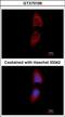 Polyribonucleotide Nucleotidyltransferase 1 antibody, MA5-27858, Invitrogen Antibodies, Immunofluorescence image 
