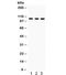 CYLD Lysine 63 Deubiquitinase antibody, R32331, NSJ Bioreagents, Western Blot image 