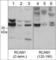 Regulator Of Calcineurin 1 antibody, RP3961, ECM Biosciences, Western Blot image 