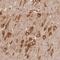 Diphosphoinositol Pentakisphosphate Kinase 2 antibody, HPA037895, Atlas Antibodies, Immunohistochemistry paraffin image 