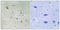 P21 (RAC1) Activated Kinase 1 antibody, LS-C199398, Lifespan Biosciences, Immunohistochemistry paraffin image 