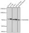 Family With Sequence Similarity 160 Member B2 antibody, GTX54018, GeneTex, Western Blot image 