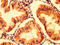Hexosaminidase Subunit Alpha antibody, LS-C669794, Lifespan Biosciences, Immunohistochemistry paraffin image 