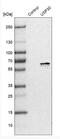 Ubiquitin Specific Peptidase 30 antibody, NBP1-81914, Novus Biologicals, Western Blot image 