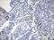 Opa Interacting Protein 5 antibody, M07819, Boster Biological Technology, Immunohistochemistry paraffin image 