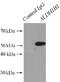 Aldehyde Dehydrogenase 1 Family Member B1 antibody, FNab00287, FineTest, Immunoprecipitation image 