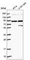 Semaphorin 3A antibody, HPA052235, Atlas Antibodies, Western Blot image 