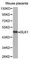 Delta Like Non-Canonical Notch Ligand 1 antibody, A00513-2, Boster Biological Technology, Western Blot image 