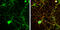 Protein Phosphatase 3 Catalytic Subunit Alpha antibody, GTX111207, GeneTex, Immunofluorescence image 