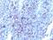 Glypican 3 antibody, NBP2-48418, Novus Biologicals, Immunohistochemistry paraffin image 
