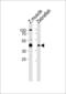 RNA Binding Motif Protein 22 antibody, MBS9209504, MyBioSource, Western Blot image 