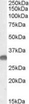 OTU Deubiquitinase, Ubiquitin Aldehyde Binding 1 antibody, PA5-18960, Invitrogen Antibodies, Western Blot image 