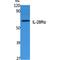 Interferon Lambda Receptor 1 antibody, LS-C386853, Lifespan Biosciences, Western Blot image 