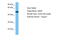 Guanine nucleotide-binding protein G(s) subunit alpha isoforms short antibody, ARP42693_P050, Aviva Systems Biology, Western Blot image 