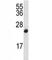 Cyclin Dependent Kinase Inhibitor 2B antibody, F43554-0.4ML, NSJ Bioreagents, Western Blot image 