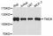 Transmembrane Channel Like 6 antibody, STJ113386, St John