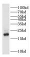 Gastrokine 2 antibody, FNab03474, FineTest, Western Blot image 