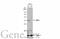 Snail Family Transcriptional Repressor 1 antibody, GTX125918, GeneTex, Western Blot image 