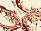 TGIF1 antibody, CSB-PA623005LA01HU, Cusabio, Immunohistochemistry paraffin image 