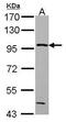 Glycogen Phosphorylase B antibody, GTX114952, GeneTex, Western Blot image 