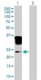 Orosomucoid 2 antibody, H00005005-B01P, Novus Biologicals, Western Blot image 