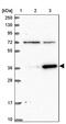 Zinc Finger Protein 609 antibody, PA5-59314, Invitrogen Antibodies, Western Blot image 