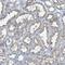 Solute Carrier Family 38 Member 6 antibody, NBP1-81010, Novus Biologicals, Immunohistochemistry frozen image 