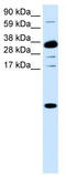 C-X-C Motif Chemokine Ligand 1 antibody, TA330384, Origene, Western Blot image 