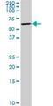 Pancreatic Lipase Related Protein 2 (Gene/Pseudogene) antibody, H00005408-D01P, Novus Biologicals, Western Blot image 