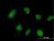 Tripartite Motif Containing 45 antibody, H00080263-B01P, Novus Biologicals, Immunofluorescence image 