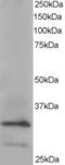 Actin Related Protein 2/3 Complex Subunit 2 antibody, EB05433, Everest Biotech, Western Blot image 