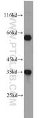 Eukaryotic Translation Initiation Factor 3 Subunit J antibody, 10439-1-AP, Proteintech Group, Western Blot image 