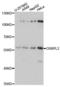 Oxysterol Binding Protein Like 2 antibody, A14199, ABclonal Technology, Western Blot image 