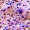 RAD51 Paralog C antibody, LS-C358269, Lifespan Biosciences, Immunohistochemistry paraffin image 