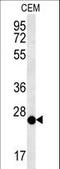 Cysteine Rich Secretory Protein LCCL Domain Containing 2 antibody, LS-C167046, Lifespan Biosciences, Western Blot image 