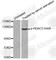 Histone Deacetylase 5 antibody, AP0202, ABclonal Technology, Western Blot image 